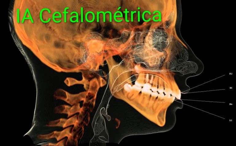 Anatomía facial geometría clínica 📐 El Análisis Cefalométrico: La Geometría Detrás de una Sonrisa En el laboratorio el análisis cefalométrico nos permite trazar líneas, ángulos y planos para descub…